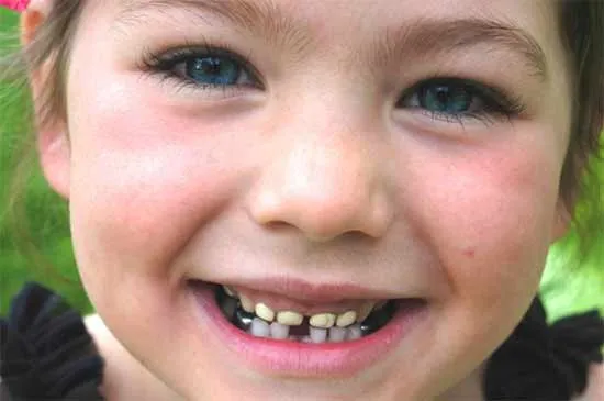 The-Girl-Who-Didn’t-Brush-her-Teeth